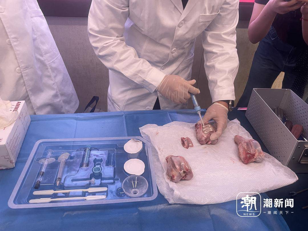 浙江团队成功研发全球首款“骨胶水”！粉碎的骨头一粘就好，未来有望一针治愈骨折