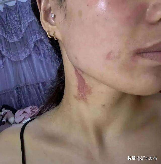 山东多地现这种虫子,千万别拍!