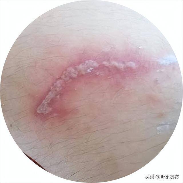 山东多地现这种虫子,千万别拍!