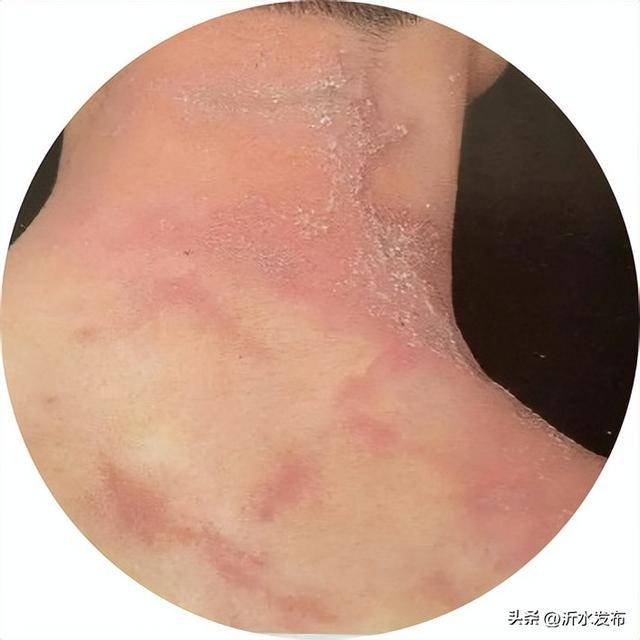 山东多地现这种虫子,千万别拍!