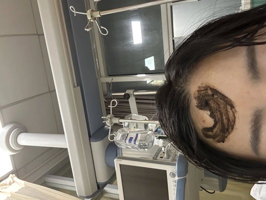 4名游客景区内遭马蜂袭击，旅游度假区：是森林公园不卖门票，蜇伤先就医后提供证据投诉